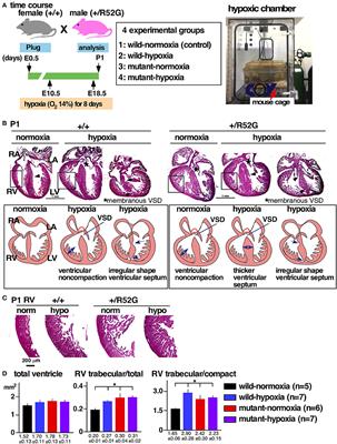 Mechanism Sharing Between Genetic and Gestational Hypoxia-Induced Cardiac Anomalies